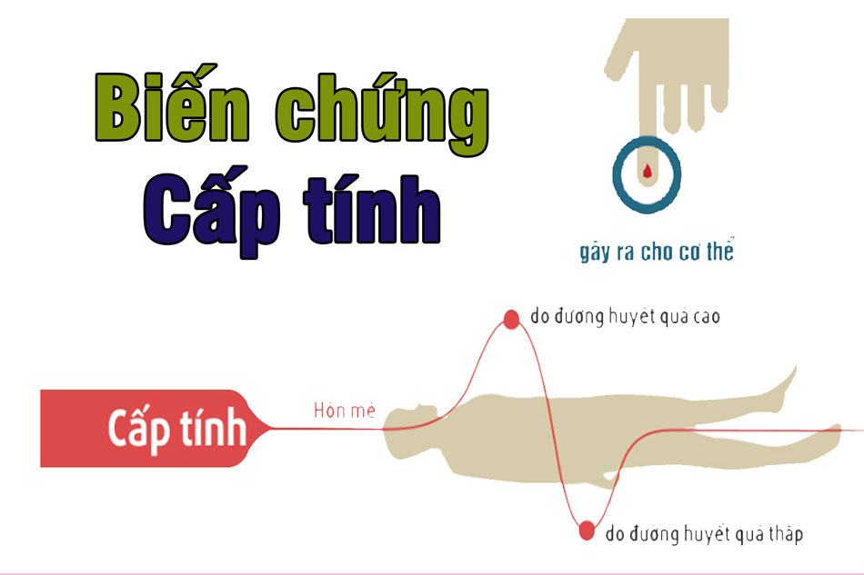 Biến chứng cấp tính