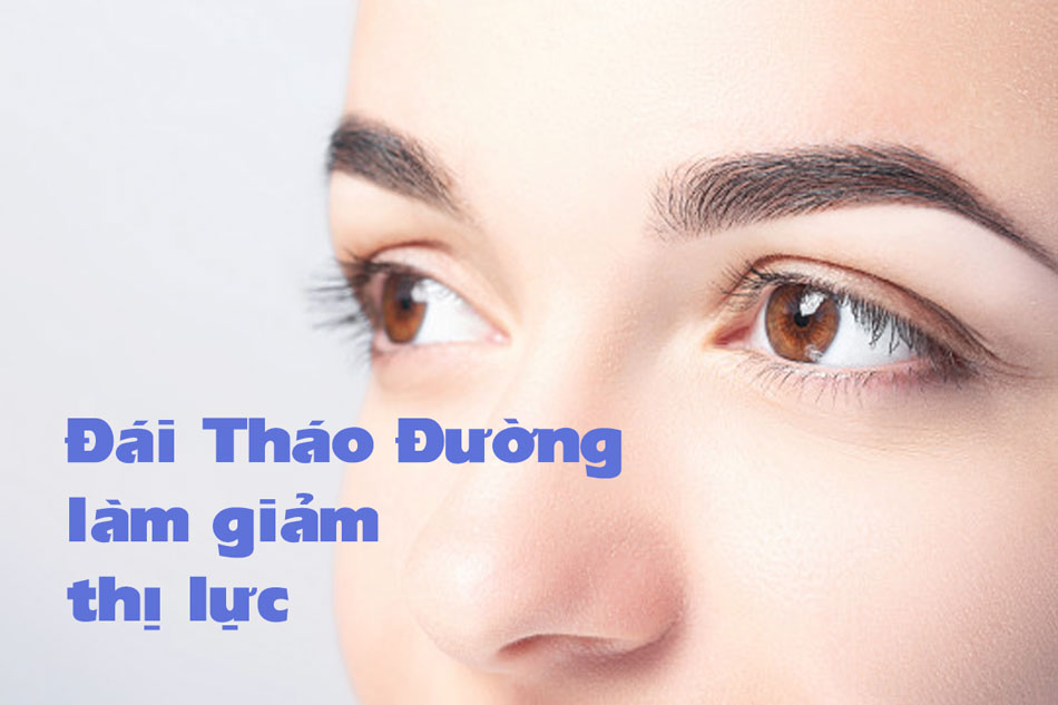 Suy giảm thị lực là dấu hiệu của Đái tháo đường