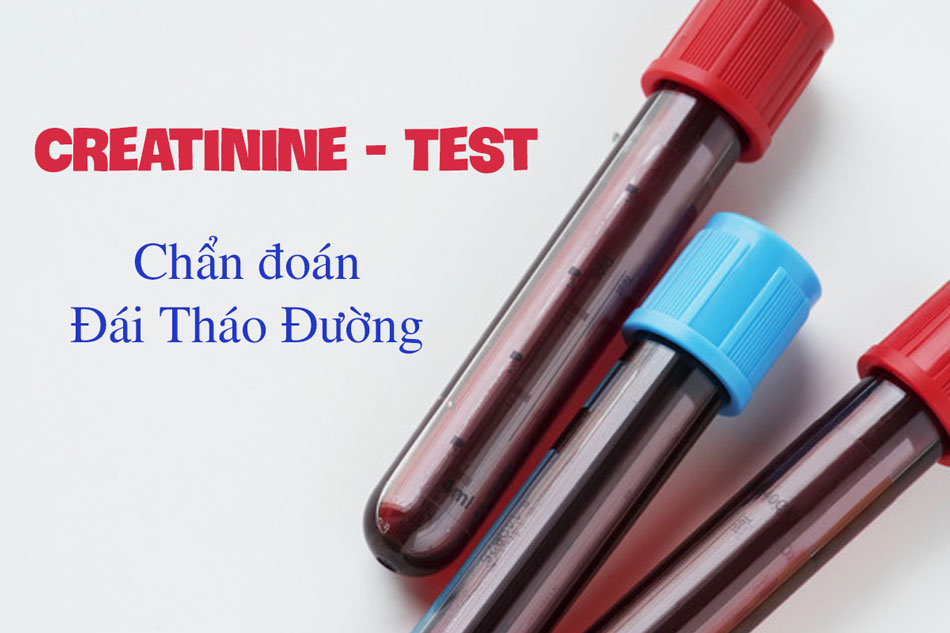 Xét nghiệm Creatinin để chẩn đoán Đái tháo đường